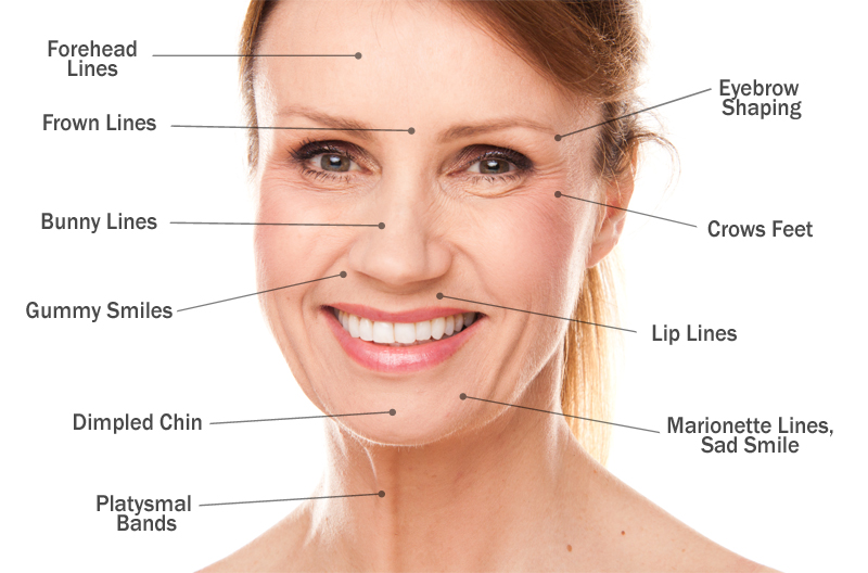 botox